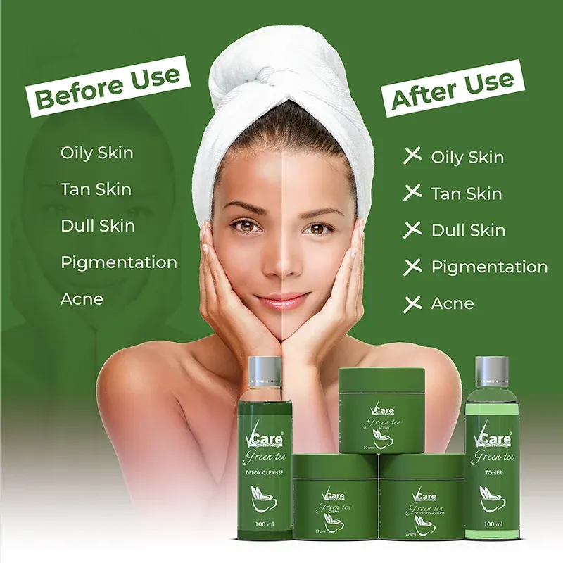 https://www.vcareproducts.com/storage/app/public/files/133/Webp products Images/Face/Facial Kits/Green Tea Facial Kit - 800 X 800 Pixels/VCARE GREEN TEA FACIAL KIT  B+ Creatives-01.webp